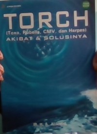 Torch